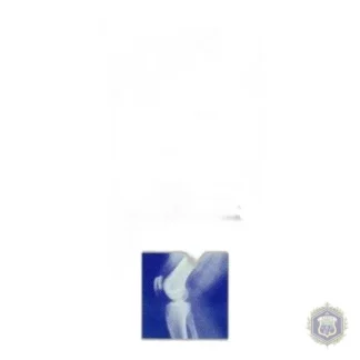 Gel for muscle and joint pains SOUPLESSIL 100 ml 100 g — zdjęcie 1